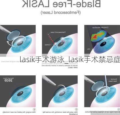 lasik手术游泳_lasik手术禁忌症